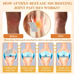 Glowrizon™ BeeEase MicroSting Joint Patches