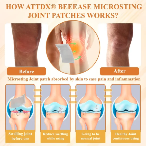 Glowrizon™ BeeEase MicroSting Joint Patches