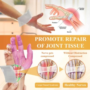 Glowrizon™ BeeEase MicroSting Joint Patches