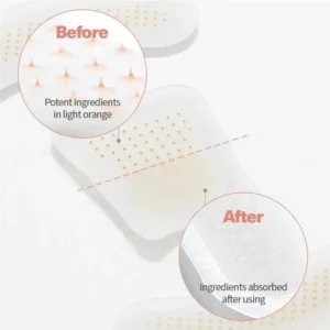 Glowrizon™ BeeEase MicroSting Joint Patches