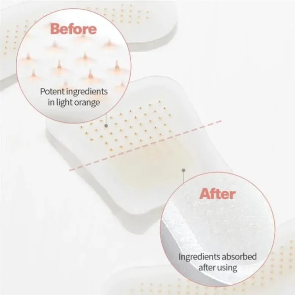 Glowrizon™ BeeEase MicroSting Joint Patches