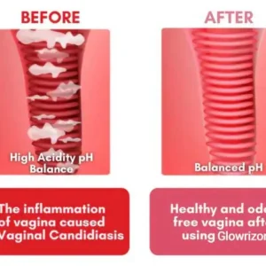 Glowrizon™ Feminine Intimate Care Cleansing Soap