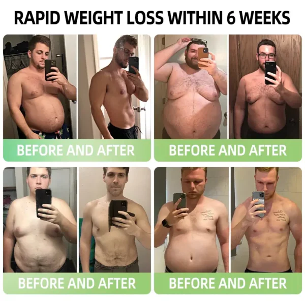 Glowrizon™ 👩‍⚕️GLP-1 Miracle Tree Extract Weight Loss Health Capsules (Food Grade Fat Burner - Developed by the Obesity Association)