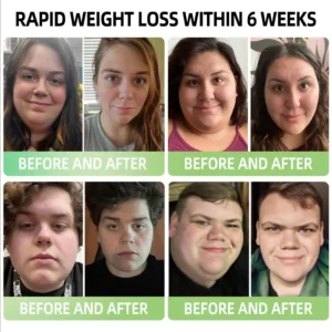 Glowrizon™ 👩‍⚕️GLP-1 Miracle Tree Extract Weight Loss Health Capsules (Food Grade Fat Burner - Developed by the Obesity Association)