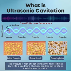 ✨[Official Store]✨🔔Glowrizon™ Ultrasonic Fat Blasting and Far Infrared Blood Sugar Balancing