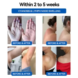 ✨[Official Store]✨🔔Glowrizon™ Ultrasonic Fat Blasting and Far Infrared Blood Sugar Balancing